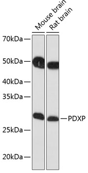 Western blot analysis of extracts of various cell lines, using PDXP Polyclonal Antibody (TA379784) at 1:1000 dilution. - Secondary antibody: HRP Goat Anti-Rabbit IgG (H+L) at 1:10000 dilution. - Lysates/proteins: 25ug per lane. - Blocking buffer: 3% nonfat dry milk in TBST. - Detection: ECL Basic Kit . - Exposure time: 10s.