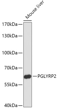 Western blot analysis of extracts of Mouse liver, using PGLYRP2 antibody (TA379849) at 1:1000 dilution. - Secondary antibody: HRP Goat Anti-Rabbit IgG (H+L) at 1:10000 dilution. - Lysates/proteins: 25ug per lane. - Blocking buffer: 3% nonfat dry milk in TBST. - Detection: ECL Enhanced Kit . - Exposure time: 90s.