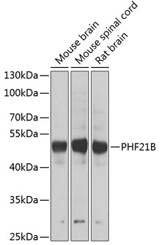 Western blot analysis of extracts of various cell lines, using PHF21B antibody (TA379872) at 1:1000 dilution. - Secondary antibody: HRP Goat Anti-Rabbit IgG (H+L) at 1:10000 dilution. - Lysates/proteins: 25ug per lane. - Blocking buffer: 3% nonfat dry milk in TBST. - Detection: ECL Basic Kit . - Exposure time: 90s.