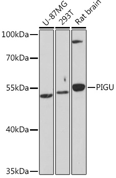 Western blot analysis of extracts of various cell lines, using PIGU Rabbit pAb (TA379921) at 1:1000 dilution. - Secondary antibody: HRP Goat Anti-Rabbit IgG (H+L) at 1:10000 dilution. - Lysates/proteins: 25ug per lane. - Blocking buffer: 3% nonfat dry milk in TBST. - Detection: ECL Basic Kit . - Exposure time: 30s.