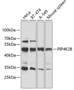 Western blot analysis of extracts of various cell lines, using PIP4K2B antibody (TA379958) at 1:1000 dilution. - Secondary antibody: HRP Goat Anti-Rabbit IgG (H+L) at 1:10000 dilution. - Lysates/proteins: 25ug per lane. - Blocking buffer: 3% nonfat dry milk in TBST. - Detection: ECL Basic Kit . - Exposure time: 30s.