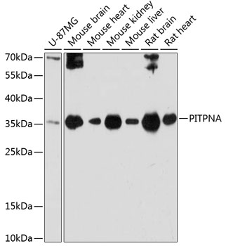 Western blot analysis of extracts of various cell lines, using PITPNA antibody (TA379964) at 1:3000 dilution. - Secondary antibody: HRP Goat Anti-Rabbit IgG (H+L) at 1:10000 dilution. - Lysates/proteins: 25ug per lane. - Blocking buffer: 3% nonfat dry milk in TBST. - Detection: ECL Basic Kit . - Exposure time: 60s.