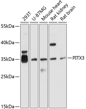 Western blot analysis of extracts of various cell lines, using PITX3 antibody (TA379970) at 1:1000 dilution. - Secondary antibody: HRP Goat Anti-Rabbit IgG (H+L) at 1:10000 dilution. - Lysates/proteins: 25ug per lane. - Blocking buffer: 3% nonfat dry milk in TBST. - Detection: ECL Basic Kit . - Exposure time: 10s.