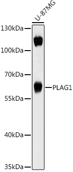 Western blot analysis of extracts of U-87MG cells, using PLAG1 antibody (TA380006) at 1:1000 dilution. - Secondary antibody: HRP Goat Anti-Rabbit IgG (H+L) at 1:10000 dilution. - Lysates/proteins: 25ug per lane. - Blocking buffer: 3% nonfat dry milk in TBST. - Detection: ECL Basic Kit . - Exposure time: 60s.