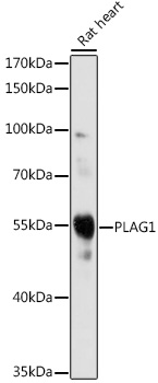 Western blot analysis of extracts of Rat heart, using PLAG1 antibody (TA380007) at 1:1000 dilution. - Secondary antibody: HRP Goat Anti-Rabbit IgG (H+L) at 1:10000 dilution. - Lysates/proteins: 25ug per lane. - Blocking buffer: 3% nonfat dry milk in TBST. - Detection: ECL Basic Kit . - Exposure time: 90s.