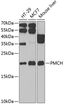 Western blot analysis of extracts of various cell lines, using PMCH antibody (TA380074) at 1:1000 dilution. - Secondary antibody: HRP Goat Anti-Rabbit IgG (H+L) at 1:10000 dilution. - Lysates/proteins: 25ug per lane. - Blocking buffer: 3% nonfat dry milk in TBST. - Detection: ECL Basic Kit . - Exposure time: 10s.