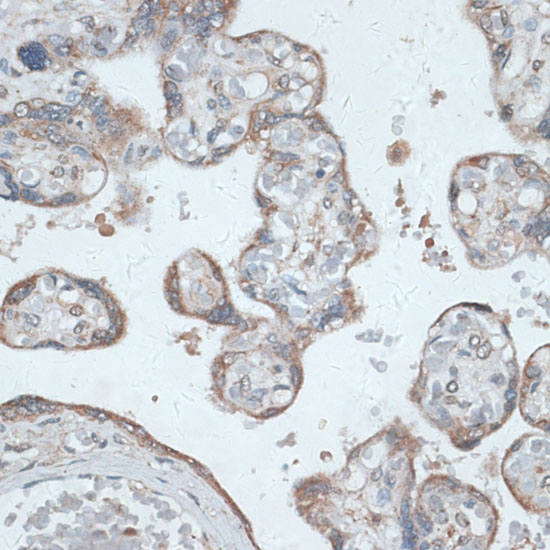 IHC staining of human lymph node paraffin section with clone 1010E1 (DX0191)