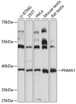 Western blot analysis of extracts of various cell lines, using PNMA1 antibody (TA380098) at 1:3000 dilution. - Secondary antibody: HRP Goat Anti-Rabbit IgG (H+L) at 1:10000 dilution. - Lysates/proteins: 25ug per lane. - Blocking buffer: 3% nonfat dry milk in TBST. - Detection: ECL Basic Kit . - Exposure time: 15s.