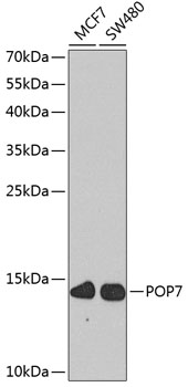 Western blot analysis of extracts of various cell lines, using POP7 antibody (TA380168) at 1:1000 dilution. - Secondary antibody: HRP Goat Anti-Rabbit IgG (H+L) at 1:10000 dilution. - Lysates/proteins: 25ug per lane. - Blocking buffer: 3% nonfat dry milk in TBST. - Detection: ECL Basic Kit . - Exposure time: 90s.