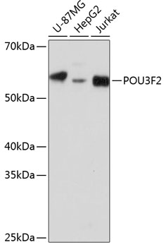 Western blot analysis of extracts of various cell lines, using POU3F2 Polyclonal Antibody (TA380179) at 1:1000 dilution. - Secondary antibody: HRP Goat Anti-Rabbit IgG (H+L) at 1:10000 dilution. - Lysates/proteins: 25ug per lane. - Blocking buffer: 3% nonfat dry milk in TBST. - Detection: ECL Basic Kit . - Exposure time: 90s.