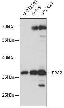 Western blot analysis of extracts of various cell lines, using PPA2 antibody (TA380187) at 1:1000 dilution. - Secondary antibody: HRP Goat Anti-Rabbit IgG (H+L) at 1:10000 dilution. - Lysates/proteins: 25ug per lane. - Blocking buffer: 3% nonfat dry milk in TBST. - Detection: ECL Basic Kit . - Exposure time: 10s.