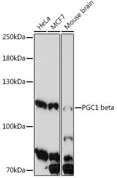 Western blot analysis of extracts of various cell line, using PGC1 beta antibody (TA380199) at 1:1000 dilution. - Secondary antibody: HRP Goat Anti-Rabbit IgG (H+L) at 1:10000 dilution. - Lysates/proteins: 25ug per lane. - Blocking buffer: 3% nonfat dry milk in TBST. - Detection: ECL Enhanced Kit . - Exposure time: 5min.
