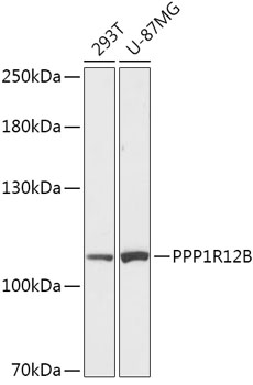 Western blot analysis of extracts of various cell lines, using PPP1R12B antibody (TA380240) at 1:1000 dilution. - Secondary antibody: HRP Goat Anti-Rabbit IgG (H+L) at 1:10000 dilution. - Lysates/proteins: 25ug per lane. - Blocking buffer: 3% nonfat dry milk in TBST. - Detection: ECL Basic Kit . - Exposure time: 90s.