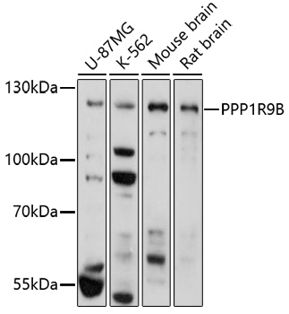 Western blot analysis of extracts of various cell lines, using PPP1R9B antibody (TA380252) at 1:1000 dilution. - Secondary antibody: HRP Goat Anti-Rabbit IgG (H+L) at 1:10000 dilution. - Lysates/proteins: 25ug per lane. - Blocking buffer: 3% nonfat dry milk in TBST. - Detection: ECL Basic Kit . - Exposure time: 3min.
