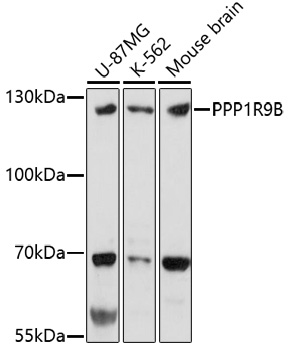 Western blot analysis of extracts of various cell lines, using PPP1R9B antibody (TA380253) at 1:1000 dilution. - Secondary antibody: HRP Goat Anti-Rabbit IgG (H+L) at 1:10000 dilution. - Lysates/proteins: 25ug per lane. - Blocking buffer: 3% nonfat dry milk in TBST. - Detection: ECL Basic Kit . - Exposure time: 3min.