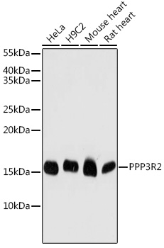 Western blot analysis of extracts of various cell lines, using PPP3R2 antibody (TA380271) at 1:1000 dilution. - Secondary antibody: HRP Goat Anti-Rabbit IgG (H+L) at 1:10000 dilution. - Lysates/proteins: 25ug per lane. - Blocking buffer: 3% nonfat dry milk in TBST. - Detection: ECL Basic Kit . - Exposure time: 180s.