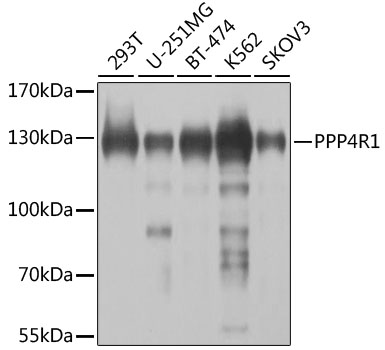 Western blot analysis of extracts of various cell lines, using PPP4R1 antibody (TA380273) at 1:1000 dilution. - Secondary antibody: HRP Goat Anti-Rabbit IgG (H+L) at 1:10000 dilution. - Lysates/proteins: 25ug per lane. - Blocking buffer: 3% nonfat dry milk in TBST. - Detection: ECL Basic Kit . - Exposure time: 5s.