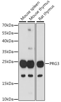 Western blot analysis of extracts of various cell lines, using PRG3 antibody (TA380315) at 1:1000 dilution. - Secondary antibody: HRP Goat Anti-Rabbit IgG (H+L) at 1:10000 dilution. - Lysates/proteins: 25ug per lane. - Blocking buffer: 3% nonfat dry milk in TBST. - Detection: ECL Basic Kit . - Exposure time: 90s.