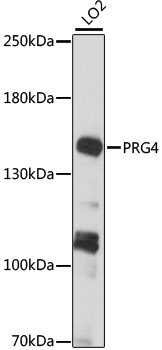 Immunoprecipitation of R34-34 antigen from 125I-surface labelled Pre-Alp cells