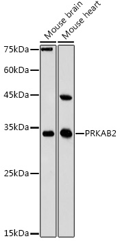 FACS staining of HEK293-gp41<sup>TM</sup> cell line (Dawood R et al, 2013)