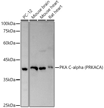 FACS staining of HEK293-gp41<sup>TM</sup> cell line (Dawood R et al, 2013)