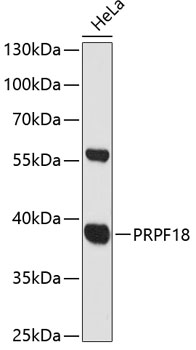 Western blot analysis of extracts of HeLa cells, using PRPF18 antibody (TA380405) at 1:3000 dilution. - Secondary antibody: HRP Goat Anti-Rabbit IgG (H+L) at 1:10000 dilution. - Lysates/proteins: 25ug per lane. - Blocking buffer: 3% nonfat dry milk in TBST. - Detection: ECL Basic Kit . - Exposure time: 90s.