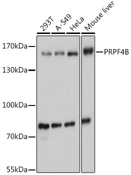 Western blot analysis of extracts of various cell lines, using PRPF4B antibody (TA380409) at 1:1000 dilution. - Secondary antibody: HRP Goat Anti-Rabbit IgG (H+L) at 1:10000 dilution. - Lysates/proteins: 25ug per lane. - Blocking buffer: 3% nonfat dry milk in TBST. - Detection: ECL Basic Kit . - Exposure time: 1s.
