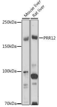 Western blot analysis of extracts of various cell lines, using PRR12 antibody (TA380418) at 1:1000 dilution. - Secondary antibody: HRP Goat Anti-Rabbit IgG (H+L) at 1:10000 dilution. - Lysates/proteins: 25ug per lane. - Blocking buffer: 3% nonfat dry milk in TBST. - Detection: ECL Basic Kit . - Exposure time: 180s.