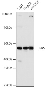 Western blot analysis of extracts of various cell lines, using PRR5 antibody (TA380420) at 1:1000 dilution. - Secondary antibody: HRP Goat Anti-Rabbit IgG (H+L) at 1:10000 dilution. - Lysates/proteins: 25ug per lane. - Blocking buffer: 3% nonfat dry milk in TBST. - Detection: ECL Basic Kit . - Exposure time: 3s.