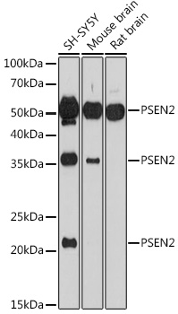 Western blot analysis of extracts of various cell lines, using PSEN2 antibody (TA380437) at 1:1000 dilution. - Secondary antibody: HRP Goat Anti-Rabbit IgG (H+L) at 1:10000 dilution. - Lysates/proteins: 25ug per lane. - Blocking buffer: 3% nonfat dry milk in TBST. - Detection: ECL Basic Kit . - Exposure time: 90s.