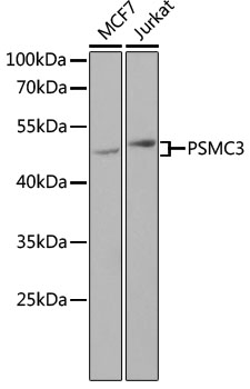 Western blot res ult of the antibody used at 2 ug/mL to detect platelet derived TGF-β at 12 ug/lane (lane 2) 6 ug/lane (lane 3), 3 ug/lane (lane 4) and 1 ug/mL (lane 5) with 4- chlorol-napthol as substrate. The bottom band is the 12.5KD TGF-β monomer, the mid-band is the 25KD TGF-β dimer and the up band is TGF-β with signal peptide. Lane 1 is molec ular weight markers.
