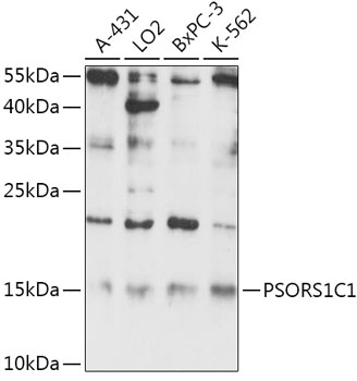 Western blot analysis of extracts of various cell lines, using PSORS1C1 antibody (TA380475) at 1:1000 dilution. - Secondary antibody: HRP Goat Anti-Rabbit IgG (H+L) at 1:10000 dilution. - Lysates/proteins: 25ug per lane. - Blocking buffer: 3% nonfat dry milk in TBST. - Detection: ECL Basic Kit . - Exposure time: 90s.