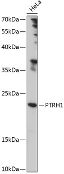 Western blot analysis of extracts of HeLa cells, using PTRH1 antibody (TA380560) at 1:1000 dilution. - Secondary antibody: HRP Goat Anti-Rabbit IgG (H+L) at 1:10000 dilution. - Lysates/proteins: 25ug per lane. - Blocking buffer: 3% nonfat dry milk in TBST. - Detection: ECL Enhanced Kit . - Exposure time: 90s.