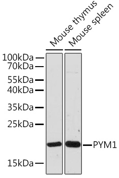 Immunohistochemical staining using MyoD1 antibody on formalin fixed, paraffin embedded human rhabdomyosarcoma.