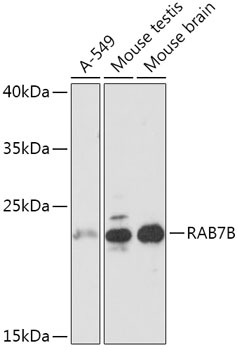 Western blot analysis of extracts of various cell lines, using RAB7B antibody (TA380648) at 1:1000 dilution. - Secondary antibody: HRP Goat Anti-Rabbit IgG (H+L) at 1:10000 dilution. - Lysates/proteins: 25ug per lane. - Blocking buffer: 3% nonfat dry milk in TBST. - Detection: ECL Basic Kit . - Exposure time: 3s.