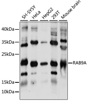 Western blot analysis with recombinant Human, Mouse and Rat soluble Podoplanin. There is no cross reaction with Human Podoplanin.