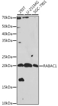 Western blot analysis using Podoplanin Antibody with recombinant Human, Mouse and Rat soluble Podoplanin. There is no cross reaction with Human Podoplanin.
