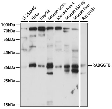 Western blot analysis of extracts of various cell lines, using RABGGTB antibody (TA380656) at 1:1000 dilution. - Secondary antibody: HRP Goat Anti-Rabbit IgG (H+L) at 1:10000 dilution. - Lysates/proteins: 25ug per lane. - Blocking buffer: 3% nonfat dry milk in TBST. - Detection: ECL Basic Kit . - Exposure time: 30s.