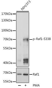 Western blot analysis of human lung cell extract with Ezrin antibody. DM380
