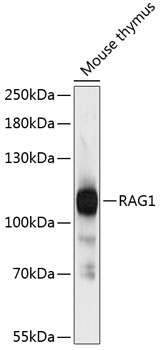 DM381 E2F-1 antibody staining of Formalin-Fixed Paraffin Embedded Human tonsil.