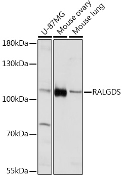Western blot analysis of extracts of various cell lines, using RALGDS Rabbit pAb (TA380691) at 1:1000 dilution. - Secondary antibody: HRP Goat Anti-Rabbit IgG (H+L) at 1:10000 dilution. - Lysates/proteins: 25ug per lane. - Blocking buffer: 3% nonfat dry milk in TBST. - Detection: ECL Basic Kit . - Exposure time: 10s.