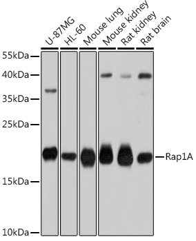 Figure 1. Western blot analysis of human lung cell extract with MSH6 antibody DM429.