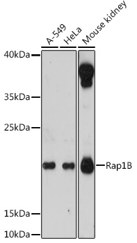Figure 1. Western blot analysis of human lung cell extract with MSH6 antibody DM429.