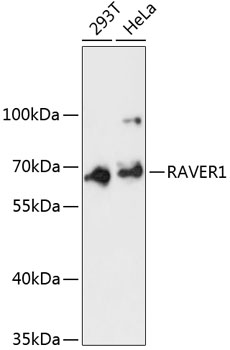 Western blot analysis of extracts of various cell lines, using RAVER1 antibody (TA380742) at 1:3000 dilution. - Secondary antibody: HRP Goat Anti-Rabbit IgG (H+L) at 1:10000 dilution. - Lysates/proteins: 25ug per lane. - Blocking buffer: 3% nonfat dry milk in TBST. - Detection: ECL Basic Kit . - Exposure time: 90s.