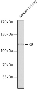 Western blot analysis in HeLa whole cell extracts using HIF Prolyl Hydroxylase 2 Antibody.