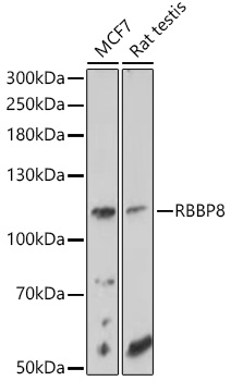 Western blot of GFP recombinant protein detected with monoclonal anti-GFP antibody. GFP recombinant protein was expressed in HeLa cells, where 50 ng (lane 1), 100 ng (lane 2) and 500 ng (lane 3) of lysate were loaded per lane. Anti-GFP detects a 27 kDa ban