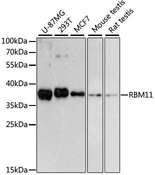 Western blot analysis of extracts of various cell lines, using RBM11 antibody (TA380767) at 1:3000 dilution. - Secondary antibody: HRP Goat Anti-Rabbit IgG (H+L) at 1:10000 dilution. - Lysates/proteins: 25ug per lane. - Blocking buffer: 3% nonfat dry milk in TBST. - Detection: ECL Basic Kit . - Exposure time: 90s.