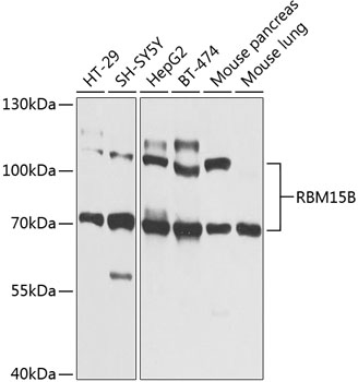 Western blot analysis of extracts of various cell lines, using RBM15B Antibody (TA380773) at 1:1000 dilution. - Secondary antibody: HRP Goat Anti-Rabbit IgG (H+L) at 1:10000 dilution. - Lysates/proteins: 25ug per lane. - Blocking buffer: 3% nonfat dry milk in TBST. - Detection: ECL Basic Kit . - Exposure time: 1s.