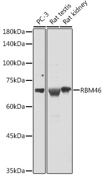 Western blot analysis of extracts of various cell lines, using RBM46 antibody (TA380785) at 1:1000 dilution. - Secondary antibody: HRP Goat Anti-Rabbit IgG (H+L) at 1:10000 dilution. - Lysates/proteins: 25ug per lane. - Blocking buffer: 3% nonfat dry milk in TBST. - Detection: ECL Basic Kit . - Exposure time: 5s.