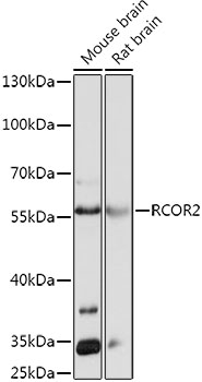 Western blot analysis of extracts of various cell lines, using RCOR2 antibody (TA380820) at 1:1000 dilution. - Secondary antibody: HRP Goat Anti-Rabbit IgG (H+L) at 1:10000 dilution. - Lysates/proteins: 25ug per lane. - Blocking buffer: 3% nonfat dry milk in TBST. - Detection: ECL Basic Kit . - Exposure time: 30s.
